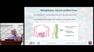 Avis de l\'oncologue : Cancer Colo Rectal (Dr D. BELABDI)