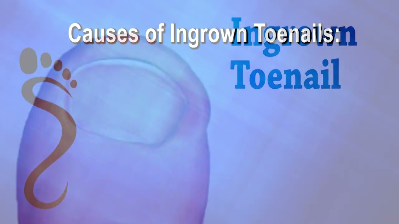 Relief from Excruciating Ingrown Toenails