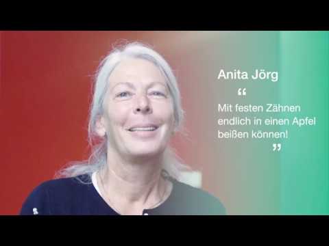 Zahnimplantat All on 4 Jörg