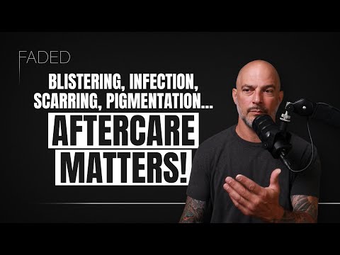 Laser Tattoo Removal Aftercare