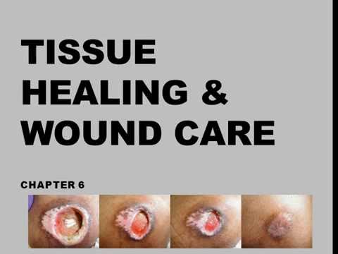 Unit 1 - 2. Tissue healing & Wound Care