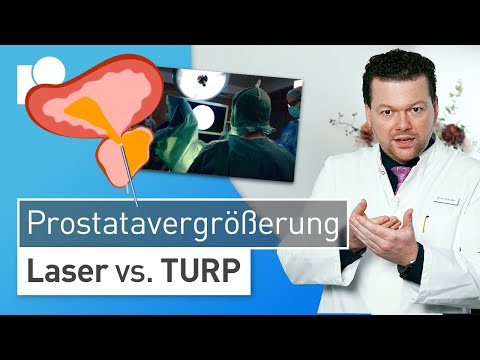 Prostatavergrößerung OP: Laser oder Ausschälung?