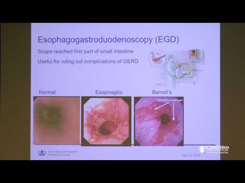 GI Dysmotility in Scleroderma: Not Just the Esophagus! - Daniela Jodorkovsky, MD