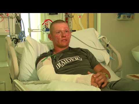 RAW INTERVIEW: Invasive plant sends teen to hospital, burn unit