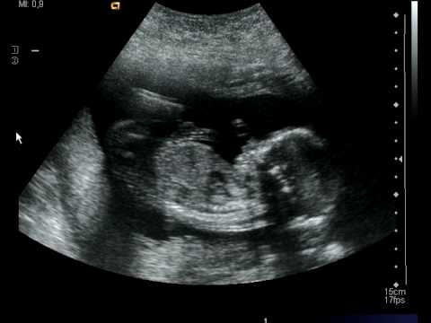 Stella i magen, vecka 19.