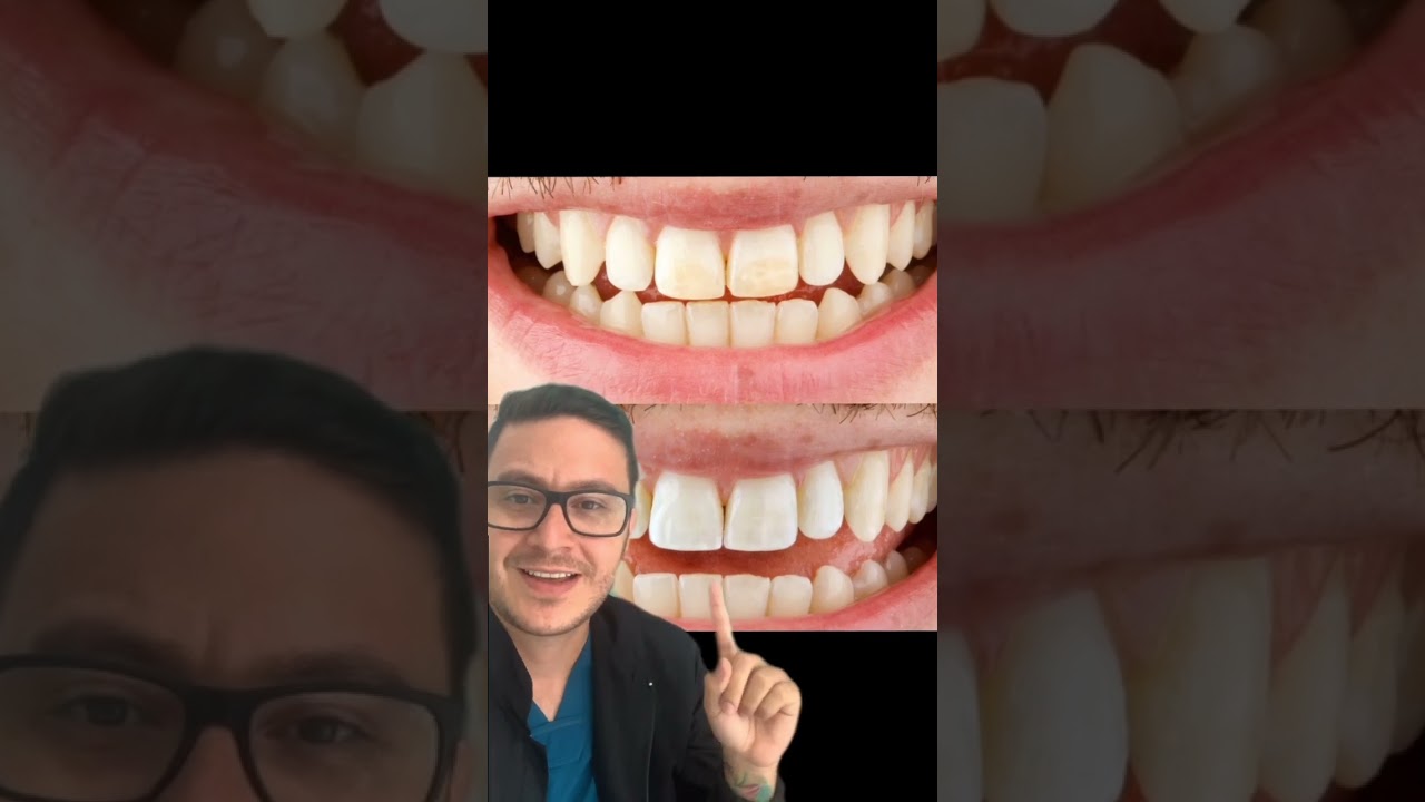 Andersson Buritica-16