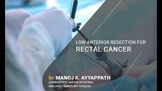 Laparoscopic Low Anterior Resection For Rectal Cancer