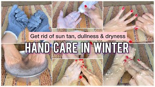 Winter Hand Care Tips Step By Step | Get wrinkles free and soft hands in 7 days |Hand care in winter