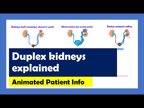 Duplex Kidneys... animated patient info
