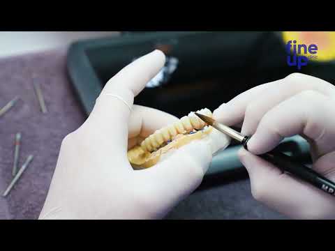 Welcome to FineUp Clinic