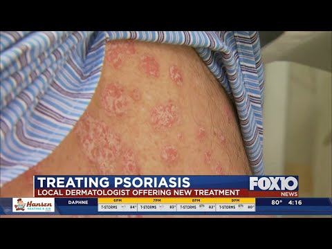 Best health insurance for psoriasis