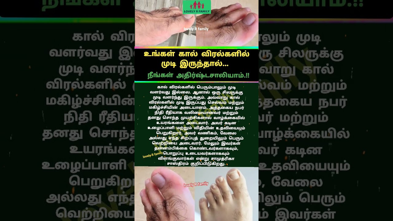 #உங்கள் #கால் #விரல்களில் #முடி #இருந்தால் #நீங்கள் #அதிர்ஷ்டசாலியாம்! #devotional#shorts#viral#art