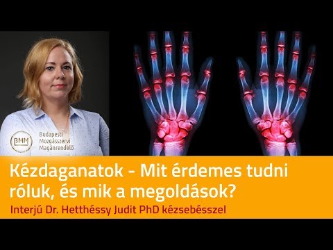 Kátrányos osteoarthritis kezelése