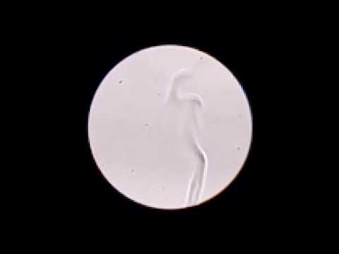 Slow Motion Schlieren Imaging