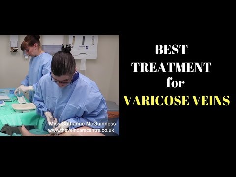 varicose girona girudoterapie barbat