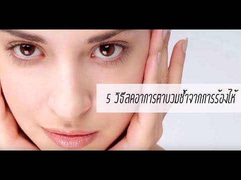 วิดีโอของโรคสะเก็ดเงินบนหัว หนังคิงคิดเห็นสำหรับโรคสะเก็ดเงิน