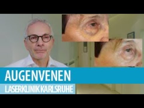 Prostata-Operation Potenz Orientalische Medizin aus der Prostata