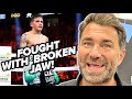 BAM RODRIGUEZ FOUGHT 6 ROUNDS W/ BROKEN JAW! EDDIE HEARN GIVES IMMEDIATE UPDATE OF BAM RODRIGUEZ