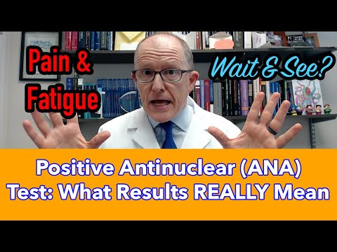 Positive Antinuclear (ANA) Antibodies Test: What the Results REALLY Mean
