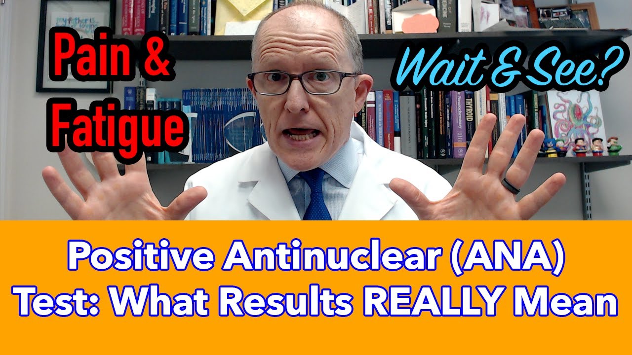 Positive Antinuclear (ANA) Antibodies Test: What the Results REALLY Mean