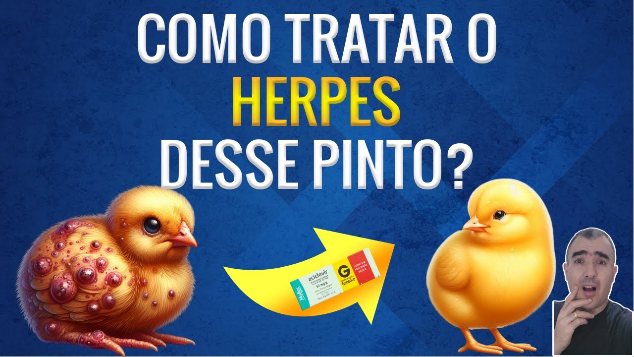 Como tratar o HERPES GENITAL