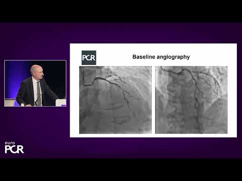 Complex PCI in high bleeding risk patients: adjust your strategy! - EuroPCR 2023