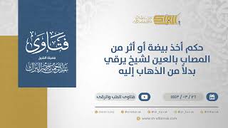 صورة حكم أخذ بيضة أو أثر من المصاب بالعين لشيخ يرقي بدلاً من الذهاب إليه - الشيخ عبدالرحمن البراك (12512)