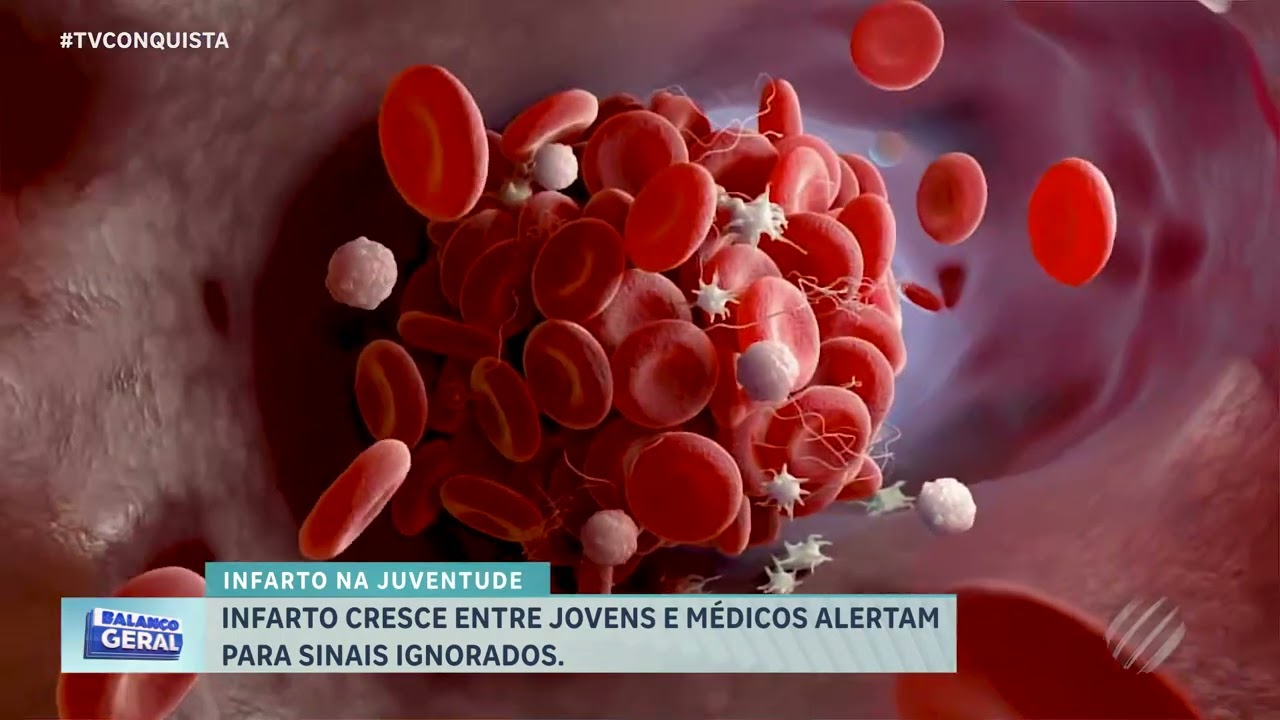 Dor no peito pode ser infarto antes dos 40? Médicos fazem alerta importante