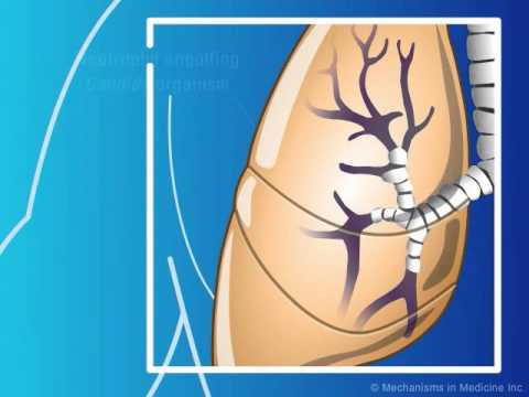 Defenses Against Candida Species - YouTube