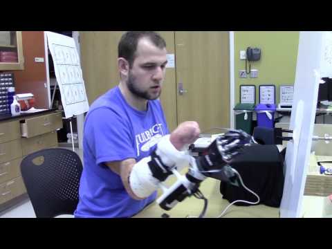 Prosthesis Grasping - Tactile Feedback
