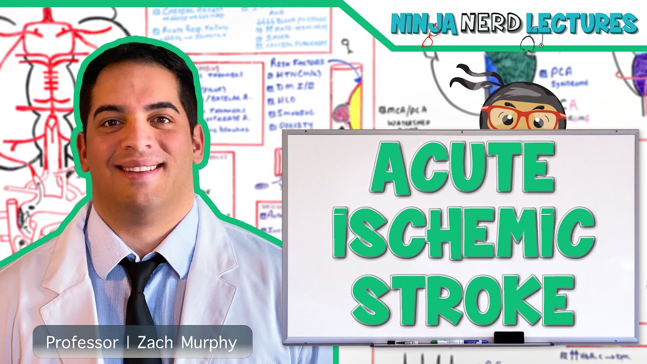 Acute Ischemic Stroke: Etiology, Pathophysiology, Clinical Features, Diagnostics, Treatment