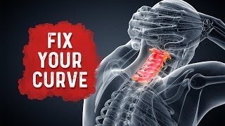 How To Fix Your Neck Posture/Curvature for Neck Pain Relief? – Dr.Berg