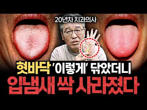 "제 아이들은 이 치약 쓰게 해요" 평생 충치 걱정 없는 최고의 치약 (박창진 원장 1부)