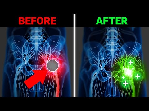 I Couldn't Fix My Sciatica Until I Did This