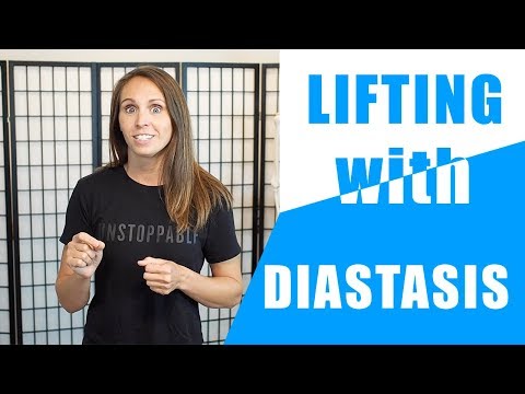 Can I Lift With a Diastasis?
