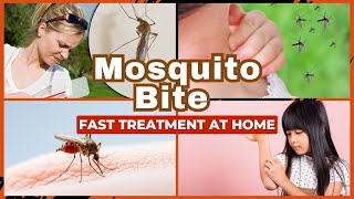 Mosquito Bite Treatment At Home?? Fast Itch Relief
