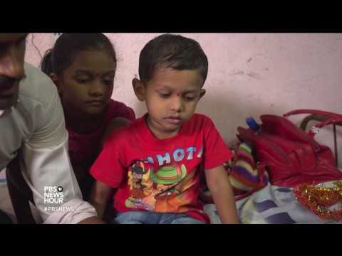 image-Is clubfoot curable permanently?