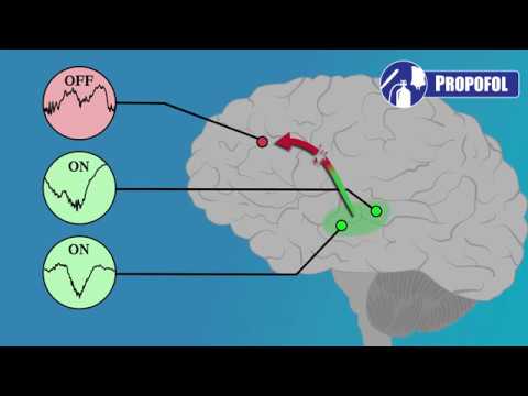 EEG for Anesthesiology - Part 3: Propofol
