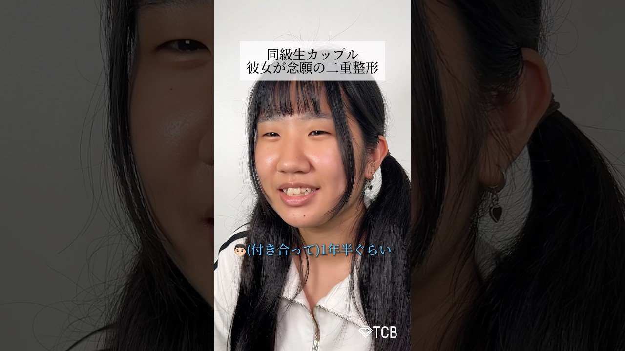 【二重整形】同級生カップル 彼女が念願の二重整形 #shorts