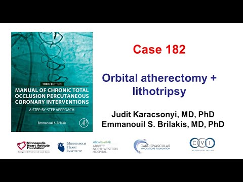 Case 182: Manual of CTO PCI - Orbital and rotational atherectomy
