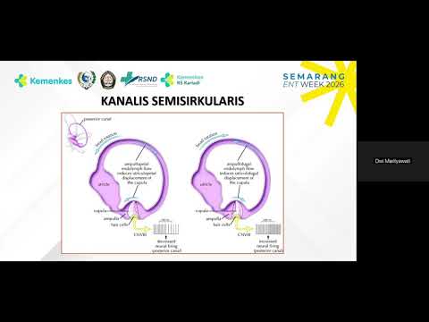 Pendekatan Klinis Vertigo Perifer