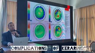 Complications of ICRS lecture in Minia keratoconus conference