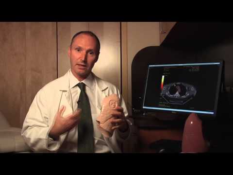 Lung Cancer Overview and Staging