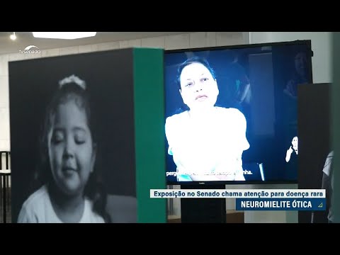 Exposição no Senado alerta para uma doença rara e grave, a neuromielite ótica