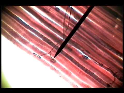 Slide 44 - Motor End Organ