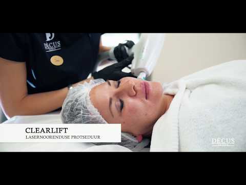 Laser procedure - Clearlift at the Decus Clinic. Tallinn, Estonia