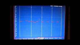 Video thumbnail for Voyetra sequencer plus gold - a little introduction by ventolinlive