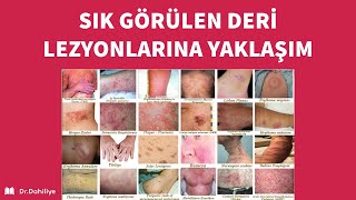 Deri Döküntülerine Yaklaşım | Dr. Hilayda Karakök