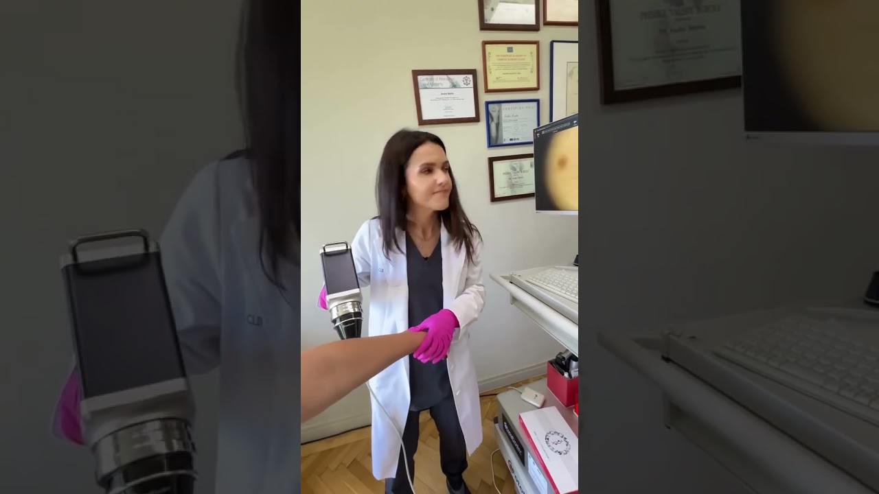 Video despre screening dermatologic