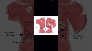 Petit's triangle (inferior lumbar triangle)bordered by iliac crest, external oblique, latissimus.